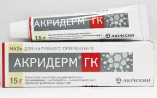 Акридерм в борьбе с прыщами: состав, виды, применение и его эффективность
