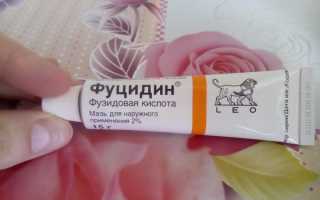 Фуцидин в борьбе с прыщами